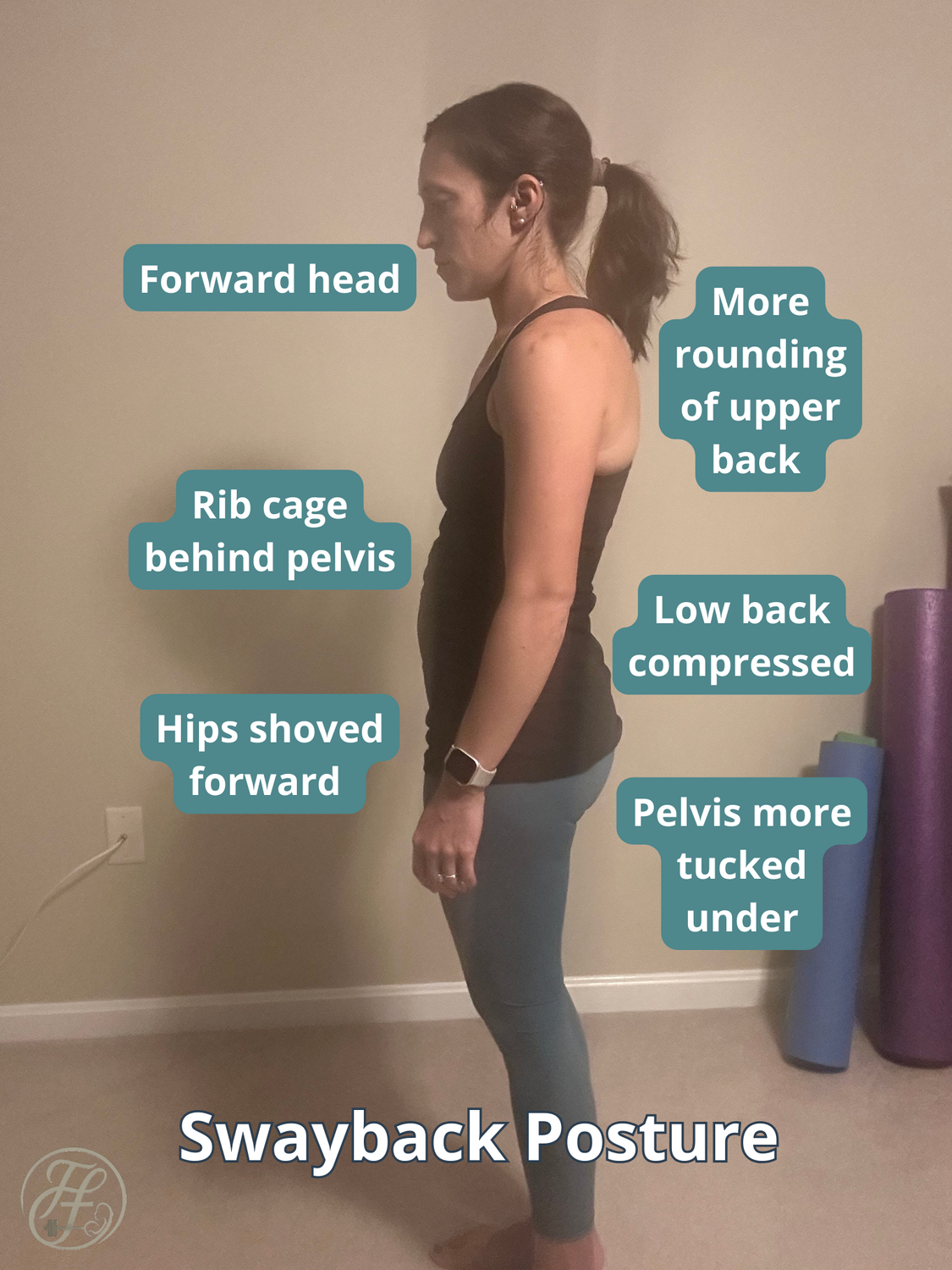 Swayback Posture